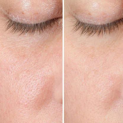 VY® Espuma Facial Detox