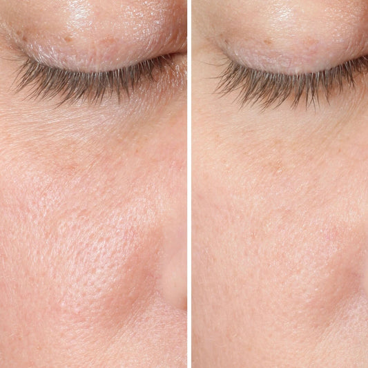 Espuma Facial Detox