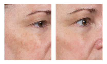Serum de Vitamina C 15%