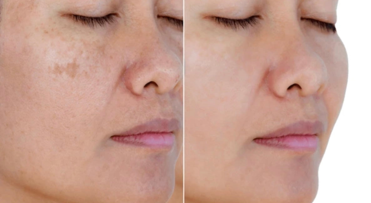 Serum Glow Up +