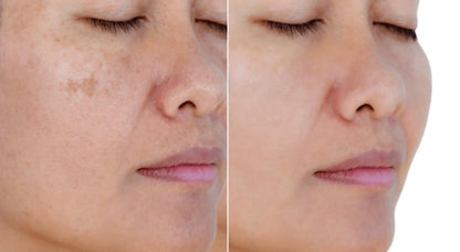 Serum Glow Up +